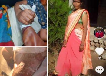 नेपालगन्ज रिफर भएकी देवकी आर्थिक अभावले घरमै, सहयोगको अपिल